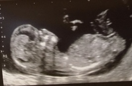 First Trimester Scottish Mamas