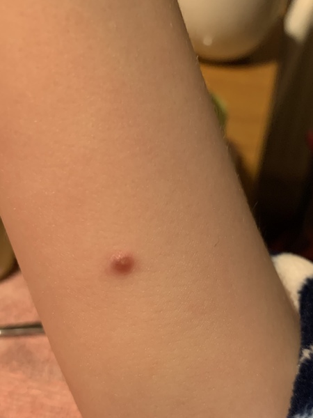 What might this spot be?