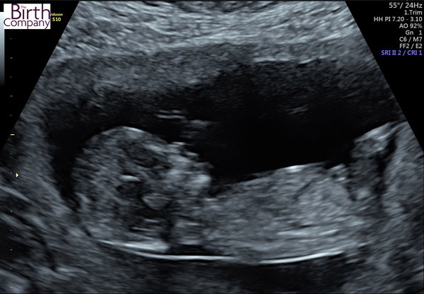 Gender guesses!