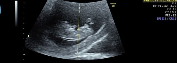 Boy or girl - just for fun!