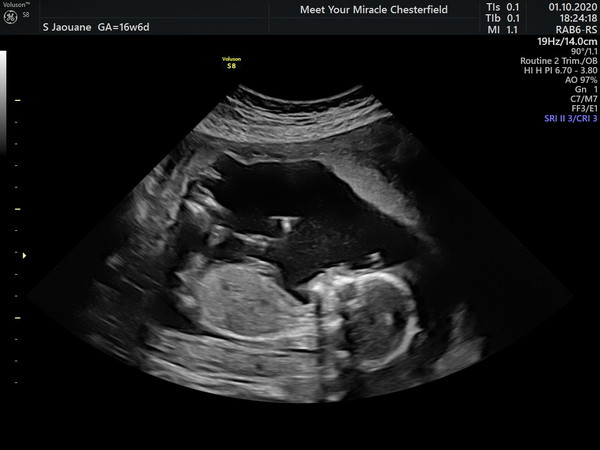 March 2021 #5