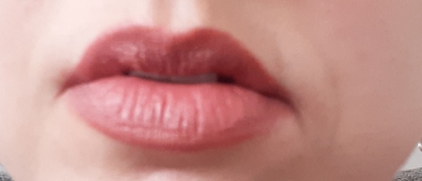 Are my lips 'normally' wrinkly? Pic attached