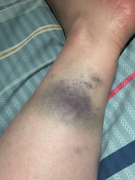 FFS. I'm such a clumsy arse.