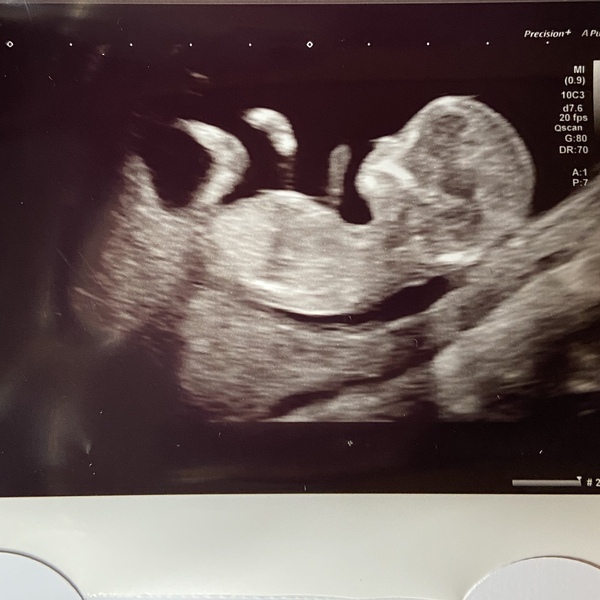 Please help, can’t stop worrying now