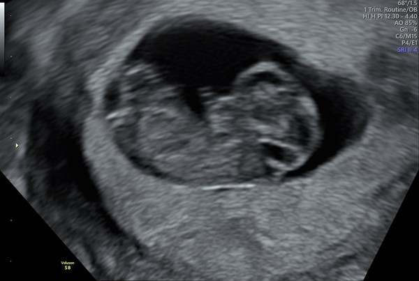 Due May 2021 Thread 2
