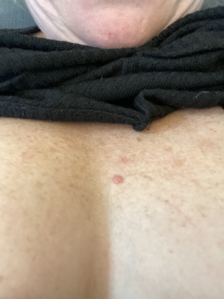 What is this on my chest?!