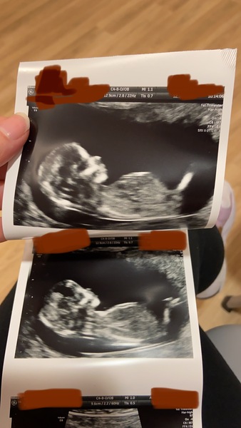 Gender guesses please 🙏🏻
