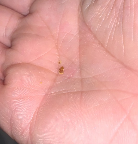 Unimpressive ear wax