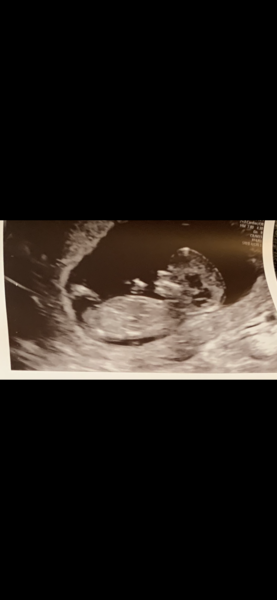 13 + 3 weeks, gender guess?