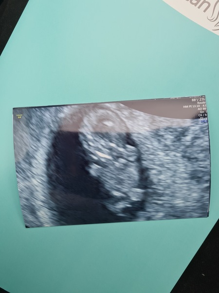 Is anyone else due on the 22nd may 2021?