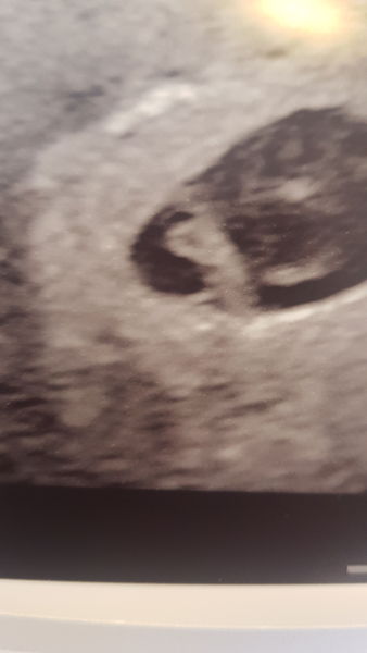 June 2021 thread 2