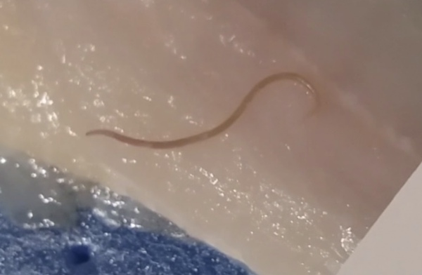 WARNING FOR THE SQUEAMISH. AIBU to freak out at this worm
