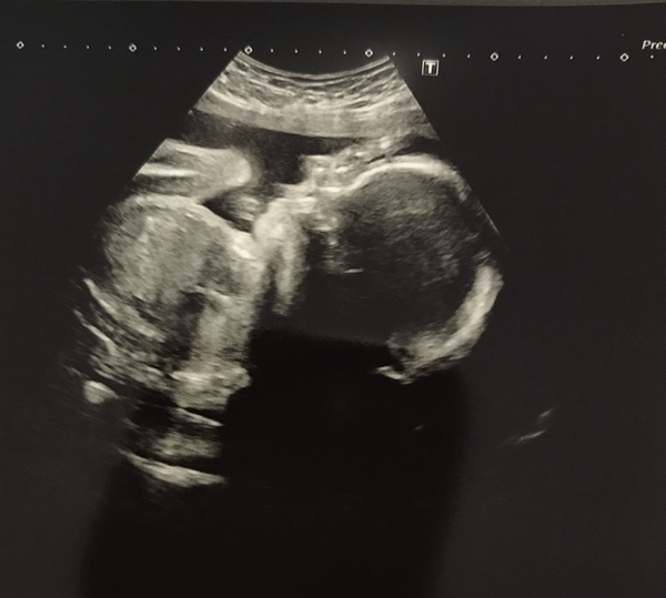 Boy or girl?