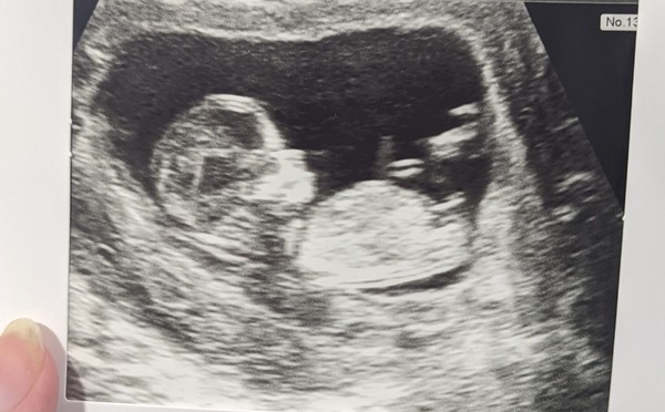 Nub theory 12 weeks 5 days (Sorry!)