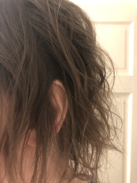 I think I might be losing my hair (Pics)