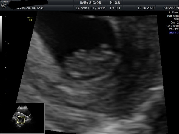 First Trimester Scottish Mamas