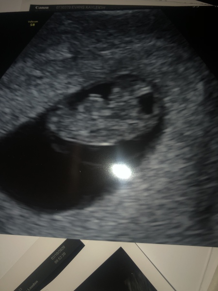 Window to the Womb - early scans