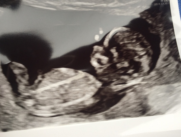 Any guesses? Boy or Girl?