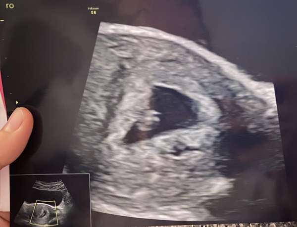 First Trimester Scottish Mamas