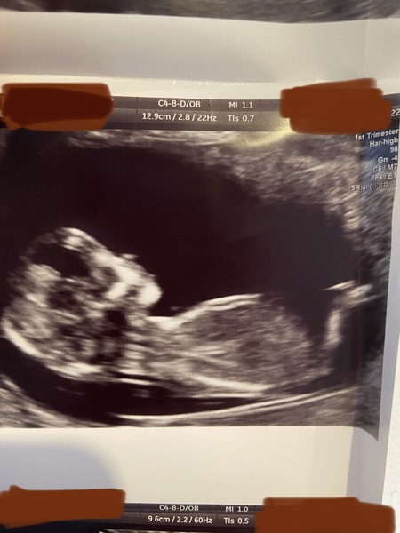 Gender guesses please 🙏🏻