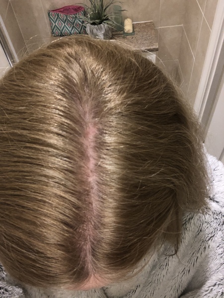 My hair..