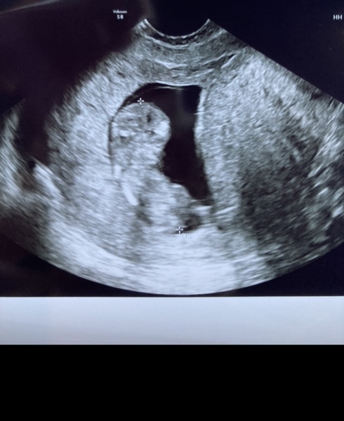 First Trimester Scottish Mamas