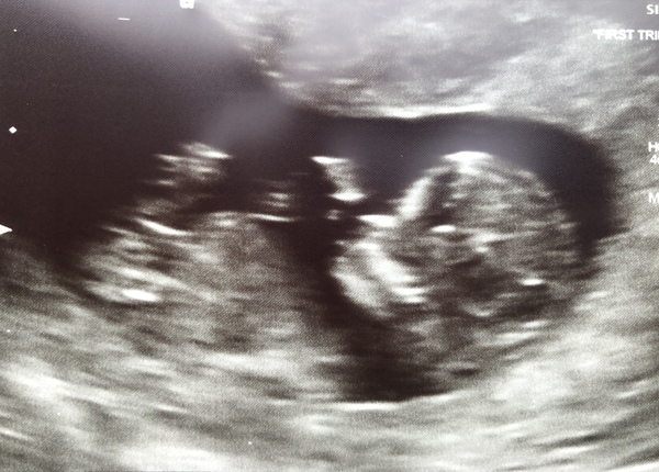 Just for fun - gender guess?