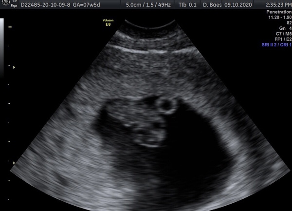 Is anyone else due on the 22nd may 2021?