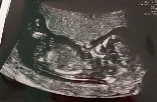 May babies 2021