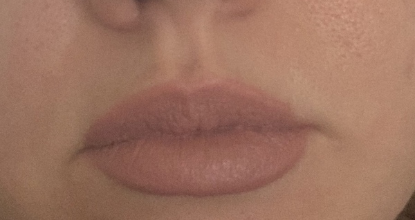Are my lips 'normally' wrinkly? Pic attached