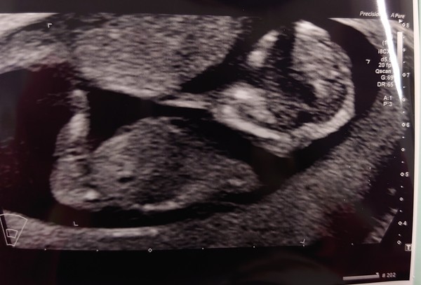 May babies 2021