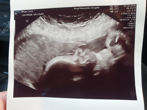 Thread 3 for us classed as more mature pregnant ladies