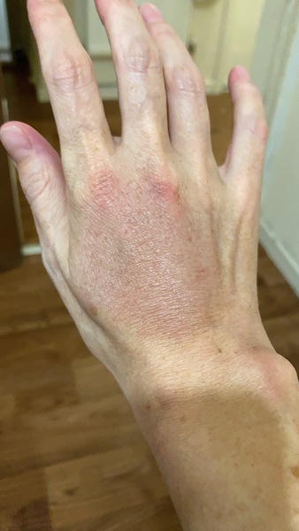 To be surprised people find cannulas painful