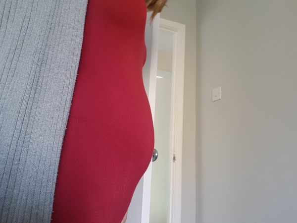 Pregnant After MMC - Thread 3