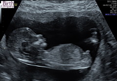 Gender guesses!