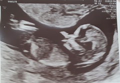 Just for fun, guess the sex!
