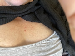 What is this on my chest?!