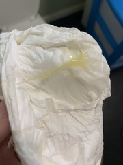 Miscarriage or implantation??