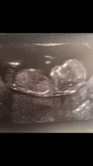 Boy or girl?