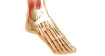 Podiatrist/bad feet/COVID