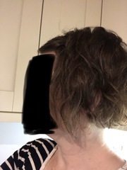 Having a hair crisis (pics)