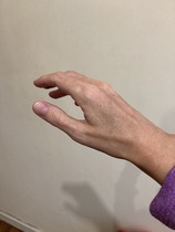 To be surprised people find cannulas painful