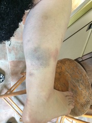 FFS. I'm such a clumsy arse.