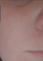 🐌 Fantastic Skincare: Jump through flaming hoops, repeat, 'Beauty is Pain', and acces to this thread will be unlocked