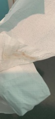 Brown vaginal discharge at 10 weeks