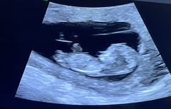 Just for fun- boy or girl