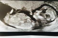 Anyone agree looks like a boy?!