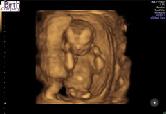 Gender guesses!