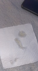 Mucus plug??