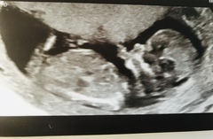 Anyone agree looks like a boy?!